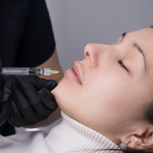 Preenchimento Labial - Casa Afrodite